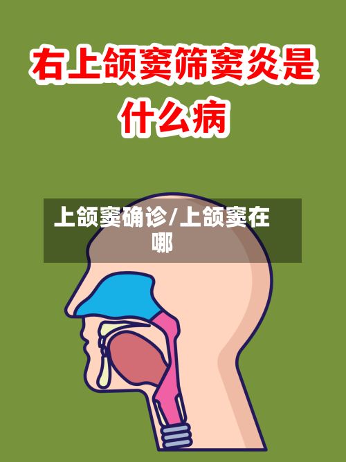 上颌窦确诊/上颌窦在哪-第2张图片