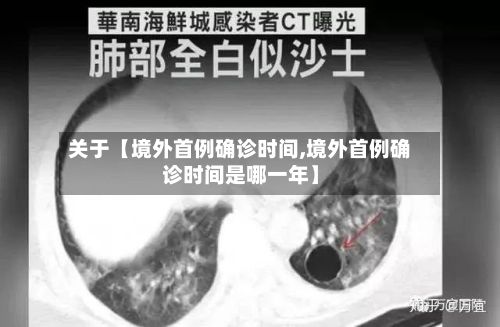 关于【境外首例确诊时间,境外首例确诊时间是哪一年】