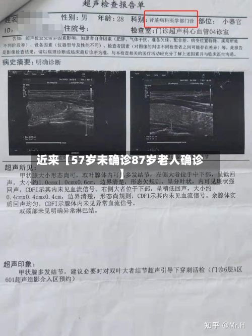 近来【57岁未确诊87岁老人确诊】