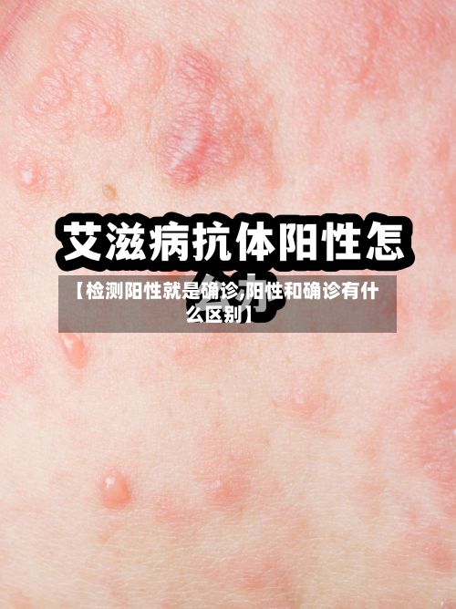 【检测阳性就是确诊,阳性和确诊有什么区别】-第2张图片