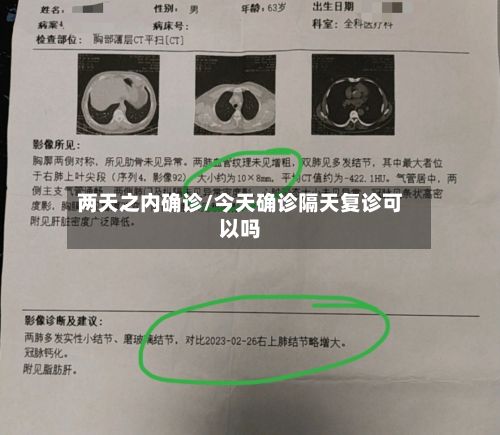 两天之内确诊/今天确诊隔天复诊可以吗