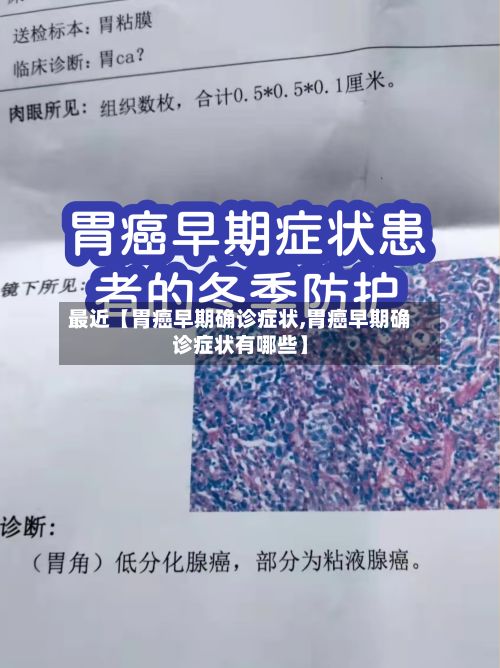最近【胃癌早期确诊症状,胃癌早期确诊症状有哪些】-第3张图片