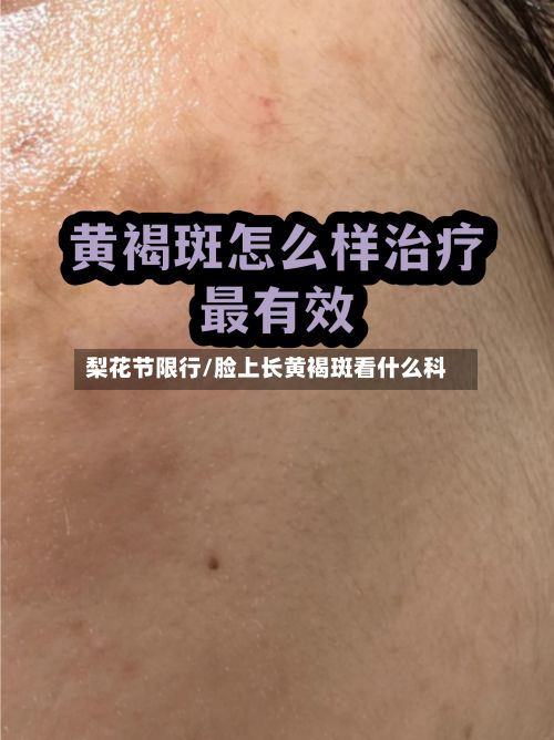 梨花节限行/脸上长黄褐斑看什么科