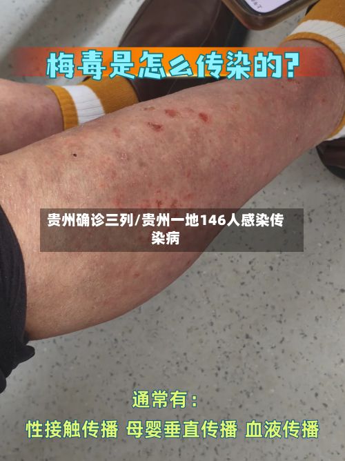 贵州确诊三列/贵州一地146人感染传染病
